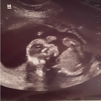 Babylist Registry Photo.