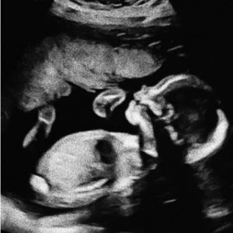 Babylist Registry Photo.