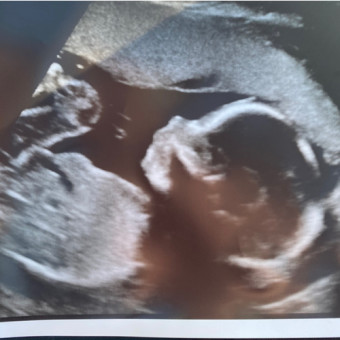 Babylist Registry Photo.