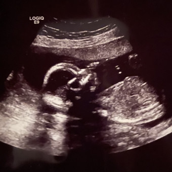 Babylist Registry Photo.