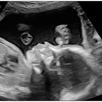 Babylist Registry Photo.