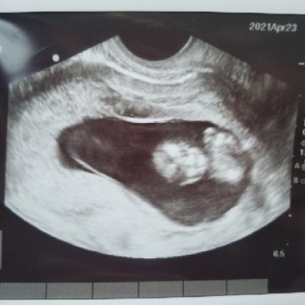 Babylist Registry Photo.
