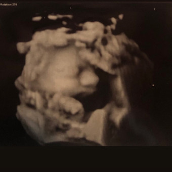 Babylist Registry Photo.