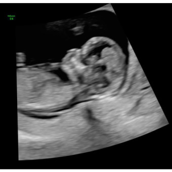 Babylist Registry Photo.