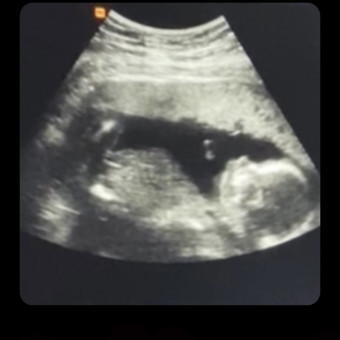 Babylist Registry Photo.