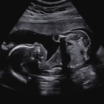 Babylist Registry Photo.