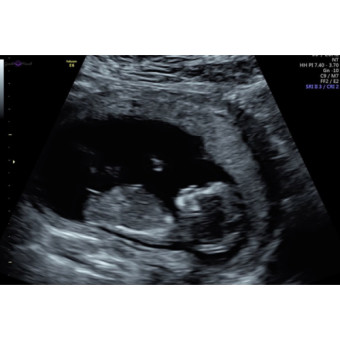 Babylist Registry Photo.