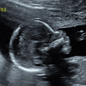 Babylist Registry Photo.