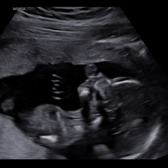 Babylist Registry Photo.
