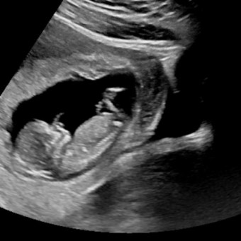 Babylist Registry Photo.