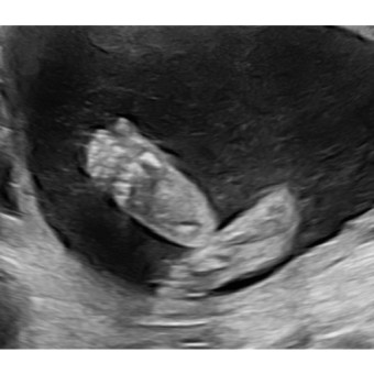 Babylist Registry Photo.