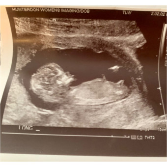 Babylist Registry Photo.