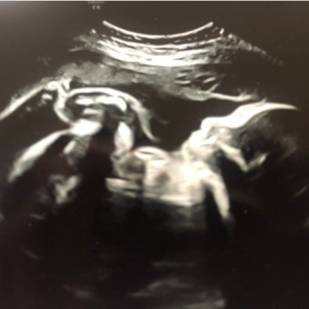 Babylist Registry Photo.