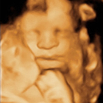 Babylist Registry Photo.
