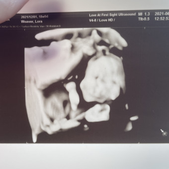 Babylist Registry Photo.