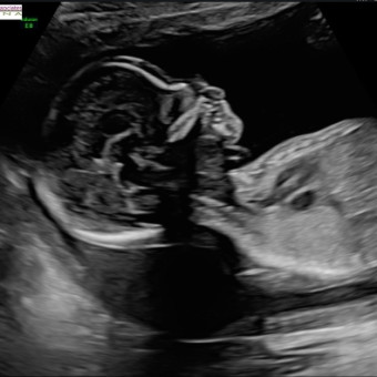 Babylist Registry Photo.
