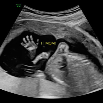 Babylist Registry Photo.