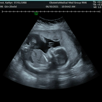 Babylist Registry Photo.