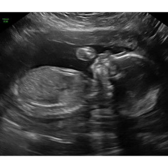 Babylist Registry Photo.