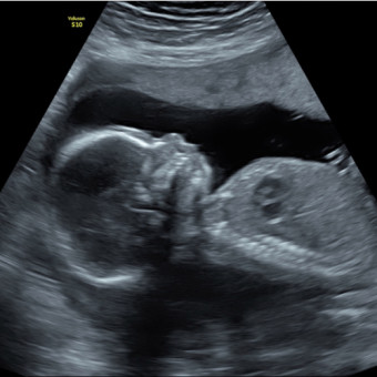 Babylist Registry Photo.