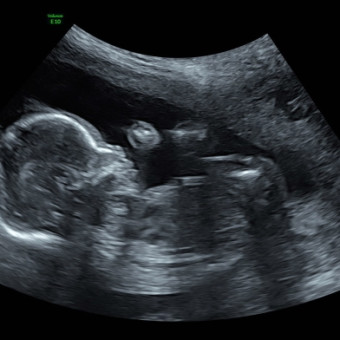 Babylist Registry Photo.