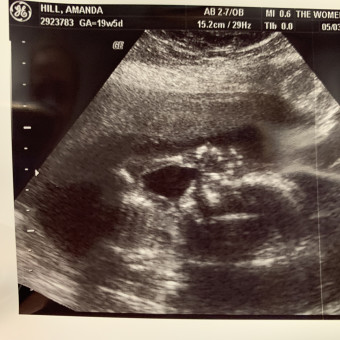 Babylist Registry Photo.