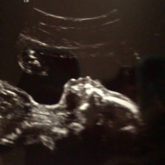 Babylist Registry Photo.