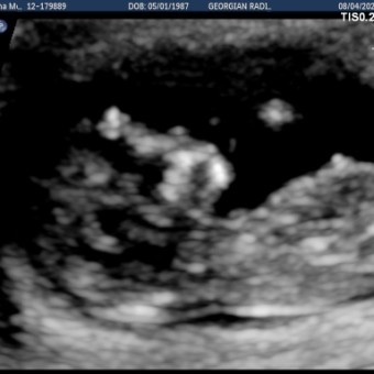 Babylist Registry Photo.