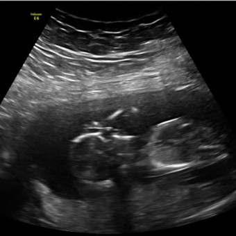 Babylist Registry Photo.