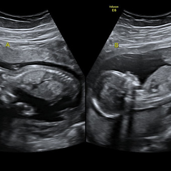 Babylist Registry Photo.