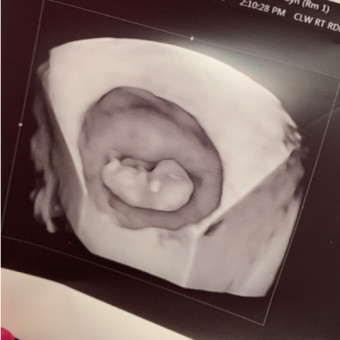 Babylist Registry Photo.