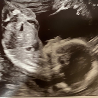 Babylist Registry Photo.