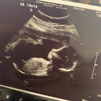Babylist Registry Photo.