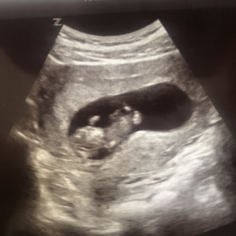 Babylist Registry Photo.