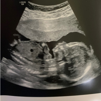 Babylist Registry Photo.