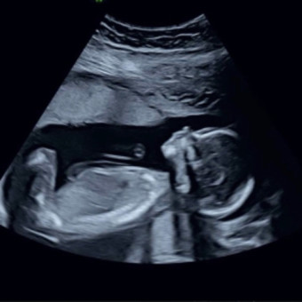 Babylist Registry Photo.