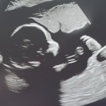 Babylist Registry Photo.