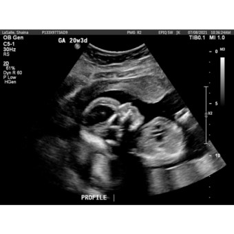Babylist Registry Photo.