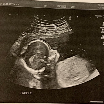 Babylist Registry Photo.