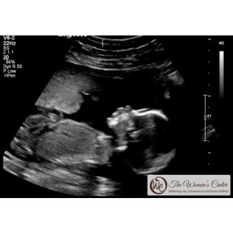 Babylist Registry Photo.