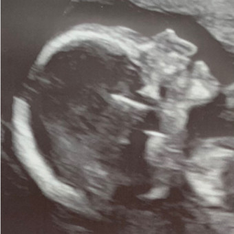 Babylist Registry Photo.