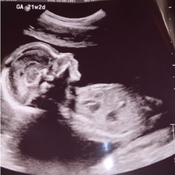 Babylist Registry Photo.