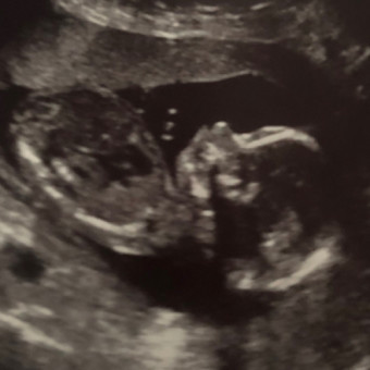 Babylist Registry Photo.