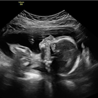 Babylist Registry Photo.