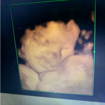 Babylist Registry Photo.