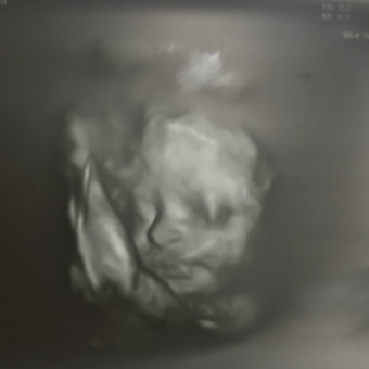 Babylist Registry Photo.