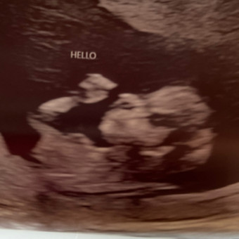 Babylist Registry Photo.