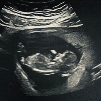 Babylist Registry Photo.