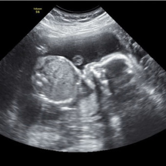 Babylist Registry Photo.