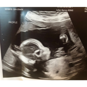 Babylist Registry Photo.